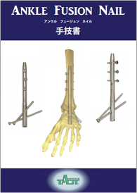 Ankle Fusion Nail 手技書