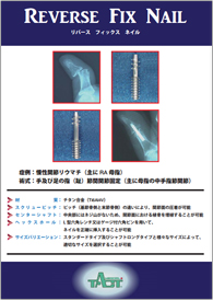 Reverse Fix Nail